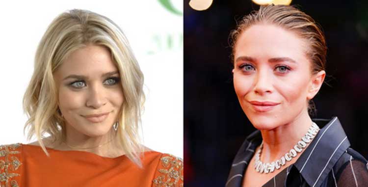 Mary-Kate Olsen plastic surgery