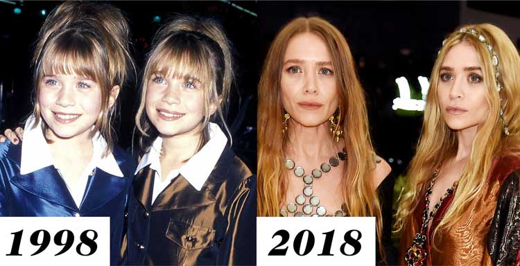 Mary-Kate Olsen plastic surgery