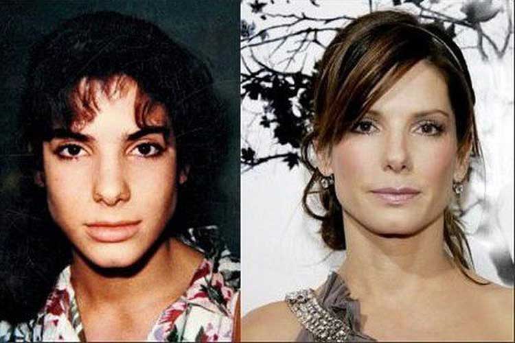 Sandra Bullock Plastic Surgery Nose job, Facelift, Botox