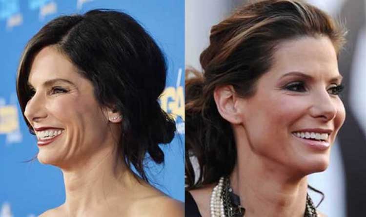 Sandra Bullock Plastic Surgery 