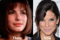 Sandra Bullock Plastic Surgery: Nose job, Facelift, Botox