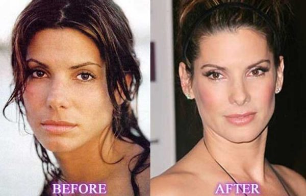 Sandra Bullock Plastic Surgery: Nose job, Facelift, Botox