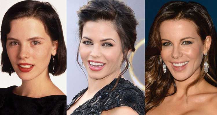 Kate Beckinsale Plastic Surgery: Botox, Boob Job, Nose job