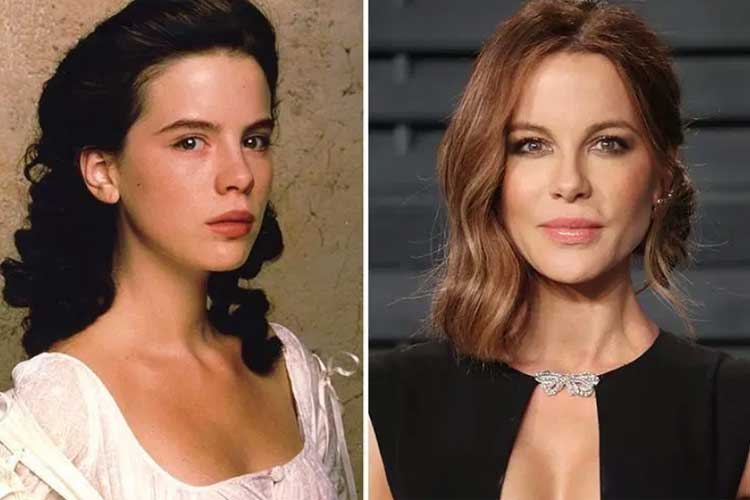 Kate Beckinsale plastic surgery