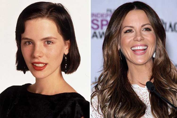 Kate Beckinsale Plastic Surgery: Botox, Boob Job, Nose job