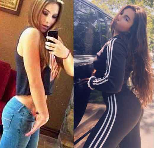 McKayla Maroney Butt Implant