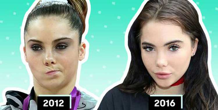 Mckayla Maroney plastic surgery 