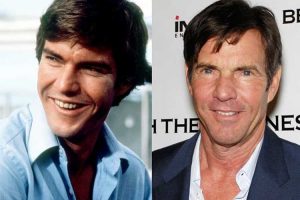 Dennis Quaid Plastic Surgery: Botox, Eyelid Surgery, Before and After