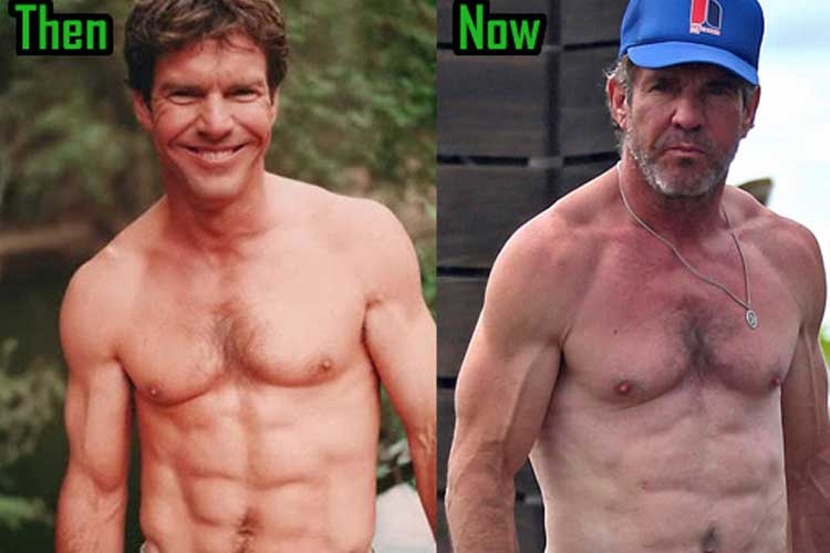 Dennis Quaid Plastic Surgery