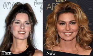 Did Shania Twain Undergo Plastic Surgery? Before and After - NewsFinale