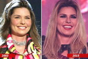 Shania Twain Plastic Surgery Botox Cheek Fillers Nose Job