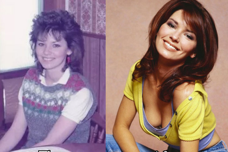 Shania Twain Plastic Surgery