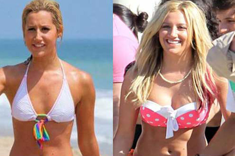 Ashley Tisdale plastic surgery