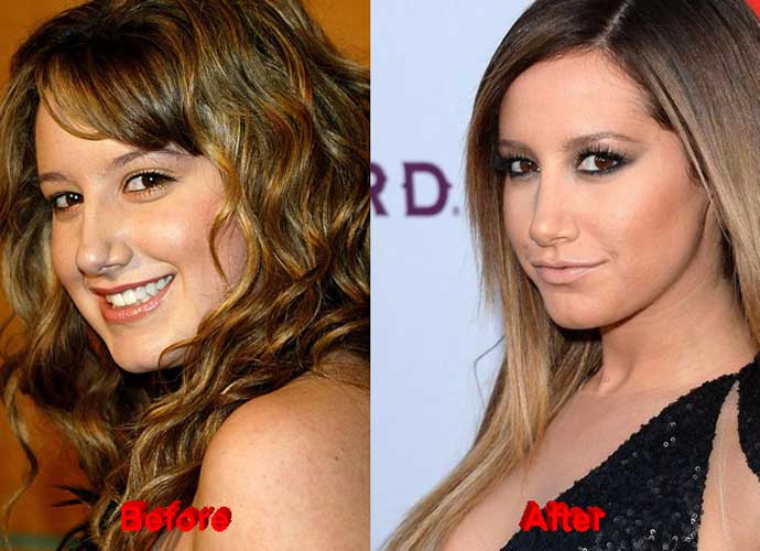 Ashley Tisdale plastic surgery