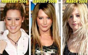 Ashley Tisdale plastic surgery: Nose Job, Boobs, Before and After