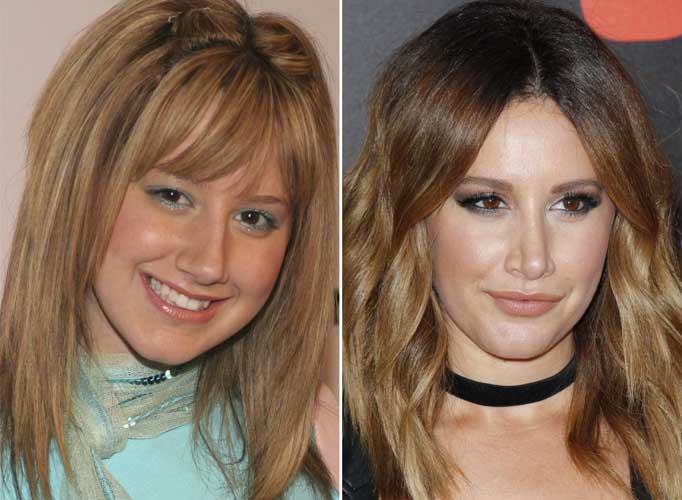 Ashley Tisdale plastic surgery: Nose Job, Boobs, Before and After