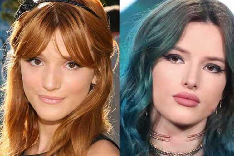 Bella Thorne Plastic Surgery