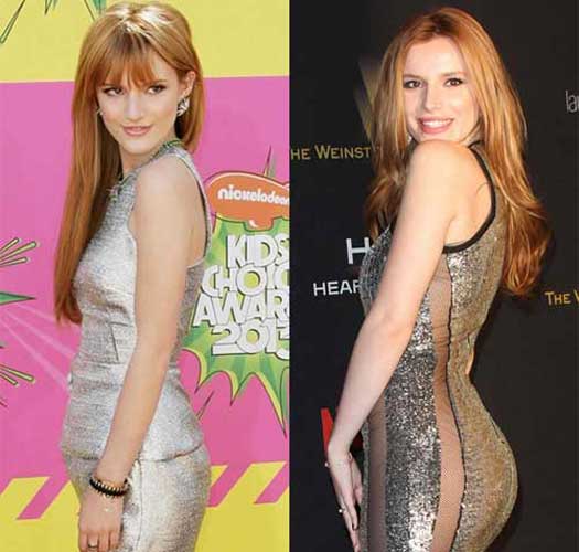 Bella Thorne Plastic Surgery