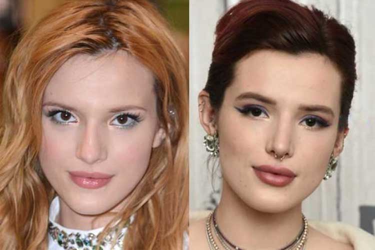 Bella Thorne Plastic Surgery