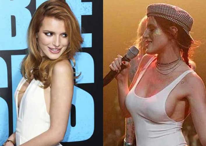 Bella Thorne Plastic Surgery