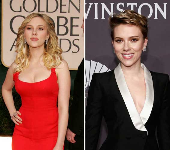 Scarlett Johansson plastic surgery 