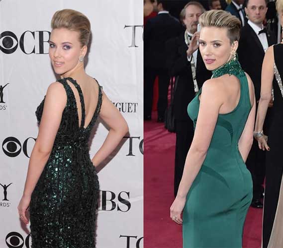 Scarlett Johansson plastic surgery 