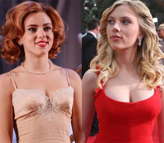 Scarlett Johansson plastic surgery 