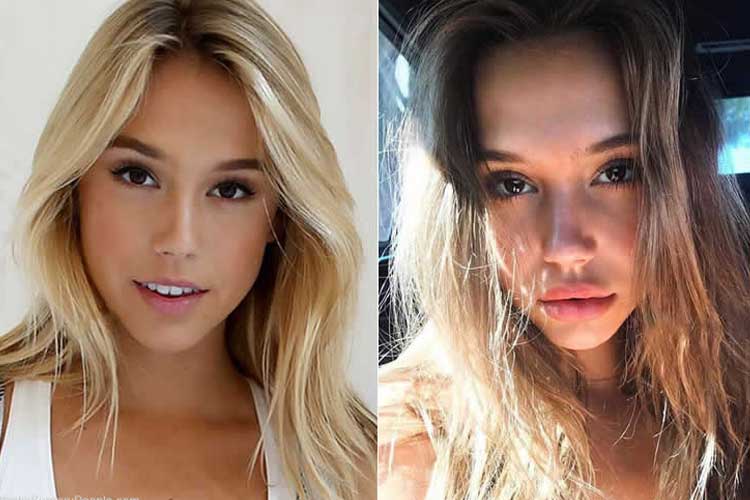 Alexis Ren Plastic Surgery