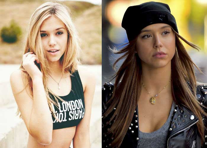 Alexis Ren Plastic Surgery