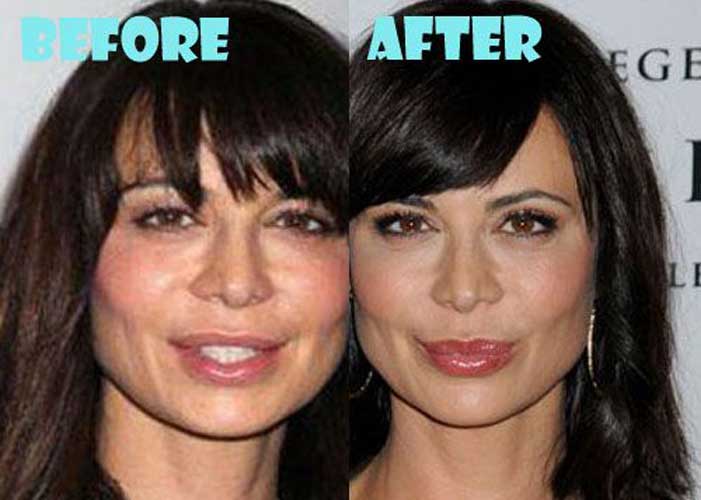 Catherine Bell Plastic Surgery 