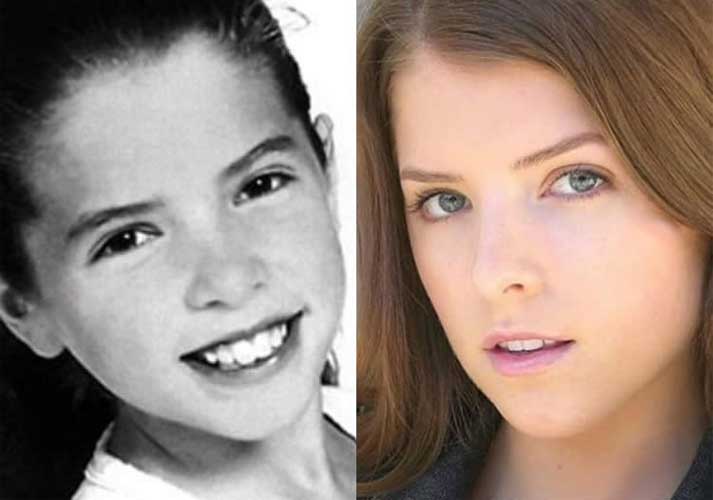 Anna Kendrick Plastic Surgery