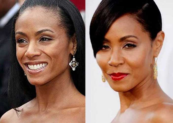 Jada Pinkett Smith Plastic surgery