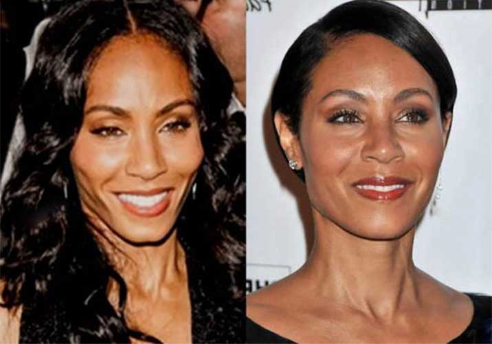 Jada Pinkett Smith Plastic surgery