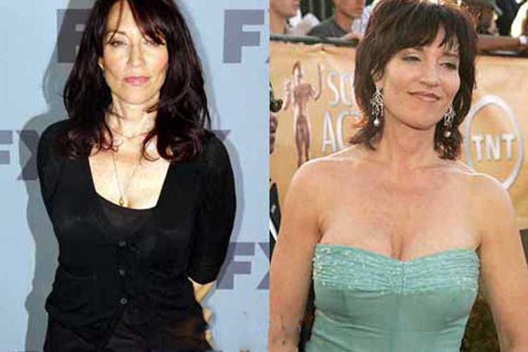 Katey Sagal Plastic Surgery