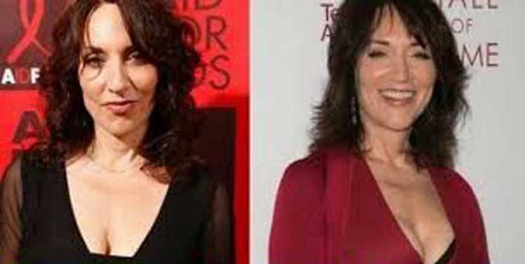 Katey Sagal Plastic Surgery