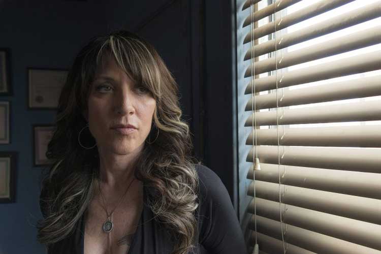 Katey Sagal Plastic Surgery