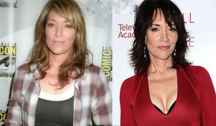 Katey Sagal Plastic Surgery