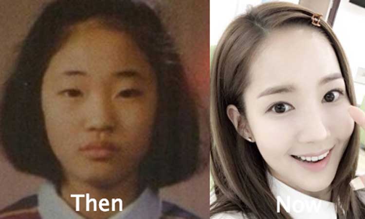 Has park min young had plastic surgery? 