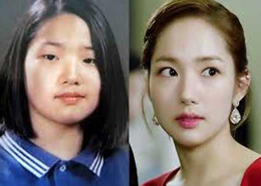 Park Min Young Nose Job