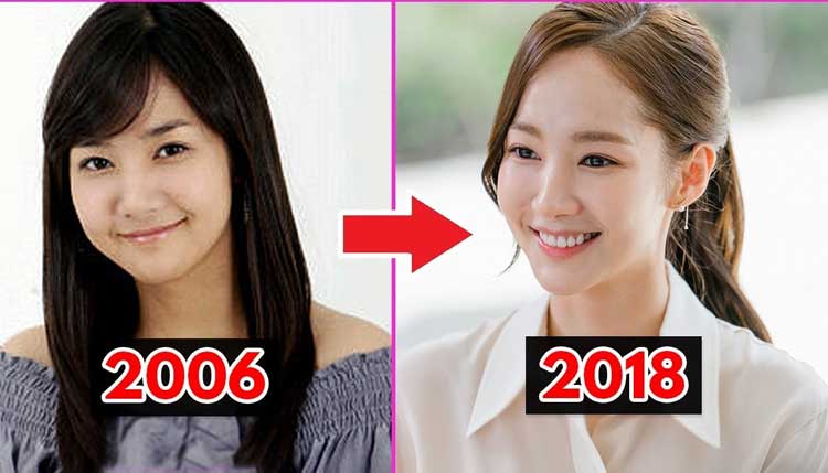 Park Min Young Plastic Surgery 