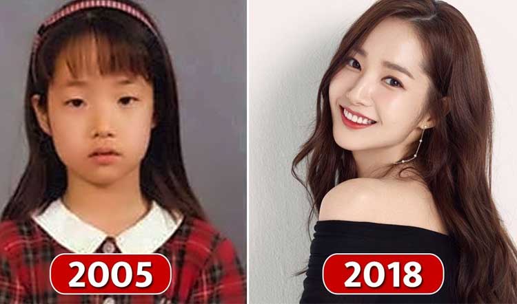 Park Min Young Plastic Surgery 