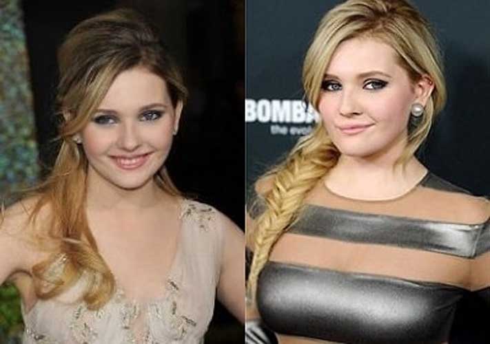 Abigail Breslin Plastic Surgery