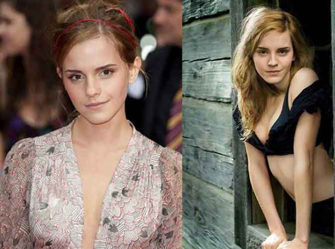 Emma Watson Plastic Surgery