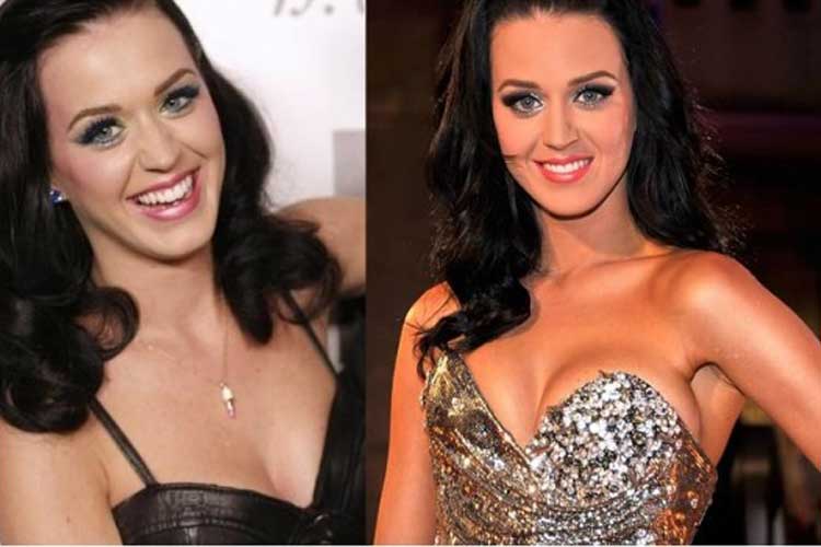 Katy Perry plastic surgery