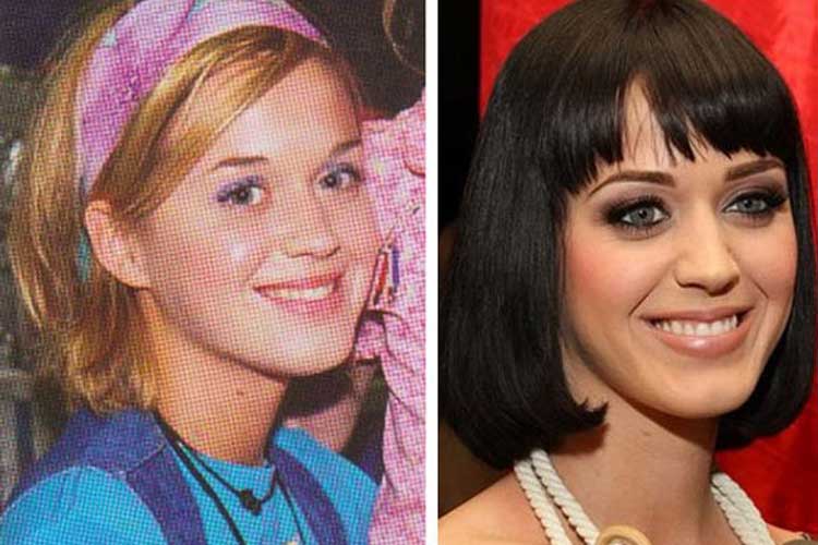 Katy Perry plastic surgery