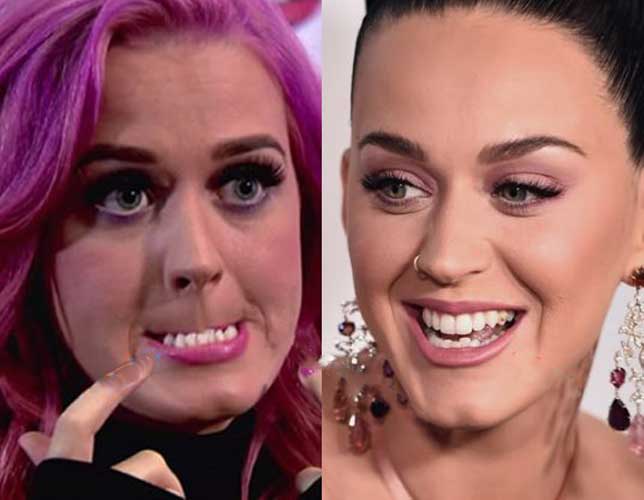 Katy Perry plastic surgery