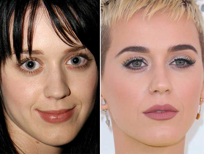 Katy Perry plastic surgery