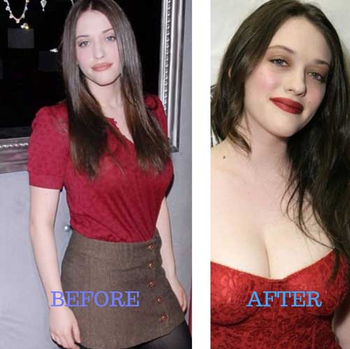 Kat Dennings Surgery: Breast Size, Before and After, Lip filler