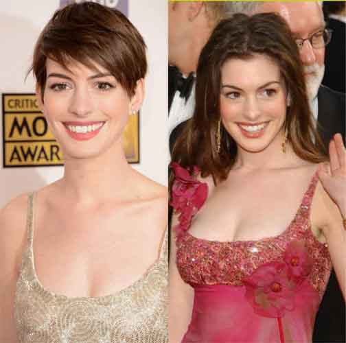 Anne Hathaway Plastic Surgery Boobs ( Boob Job), Nose Job, Lip Filler