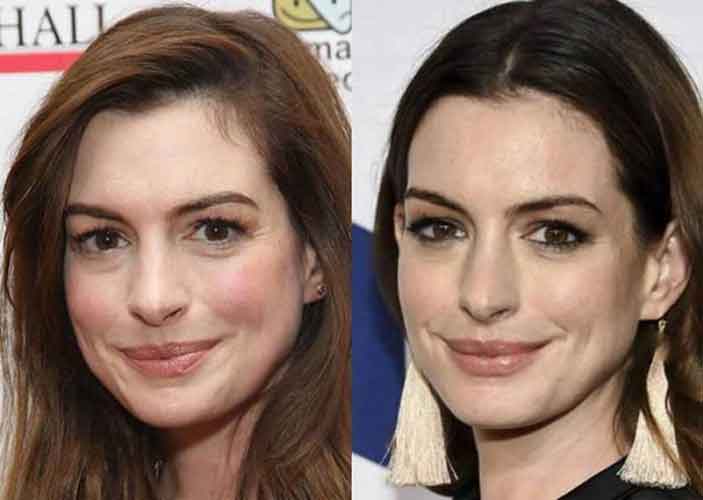 Anne Hathaway Plastic Surgery: Boobs ( Boob Job), Nose Job, Lip Filler